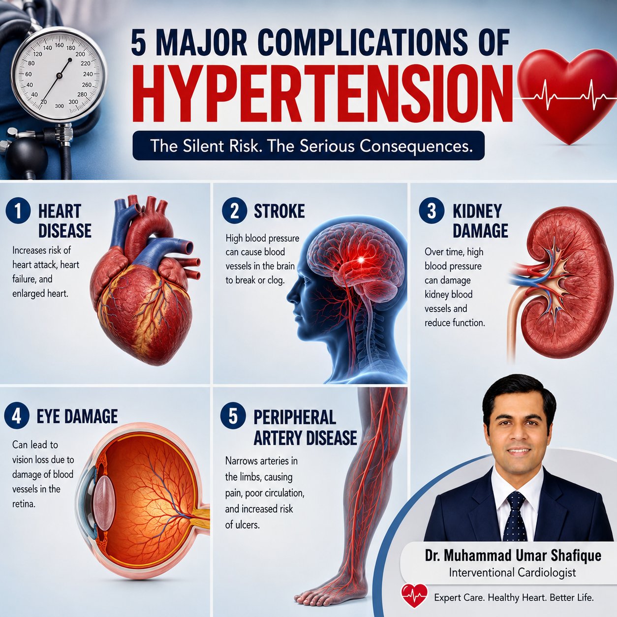complications of Hypertension - your silent enemy